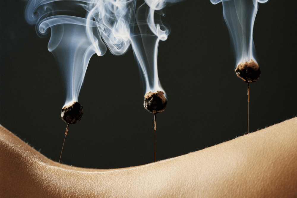 moxibustion-breech-presentation