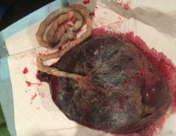 Checking the Placenta 