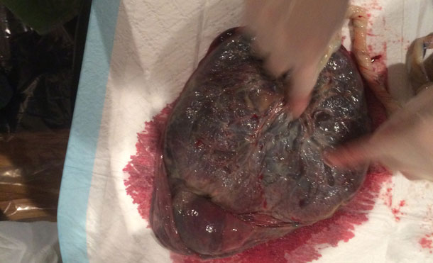 Checking the Placenta 