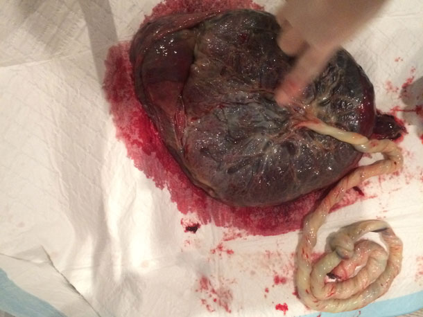 Checking the Placenta