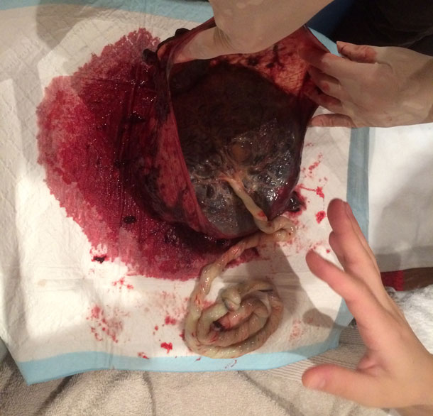 Checking the Placenta 