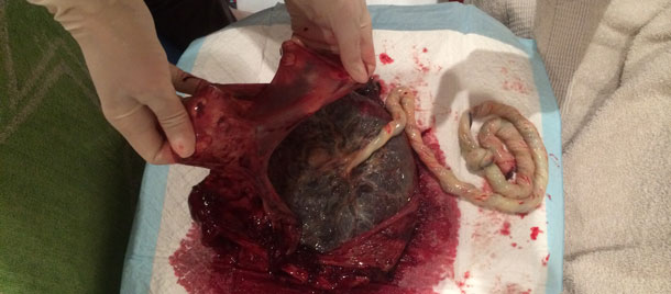 Checking the Placenta 