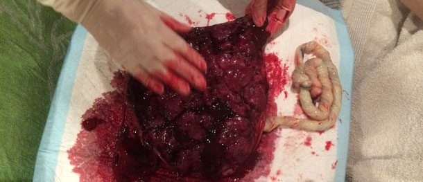Checking the Placenta 