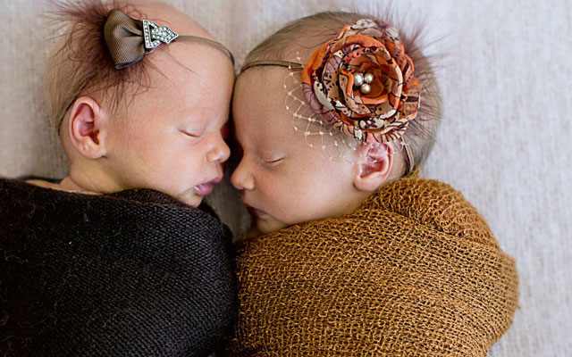 Twin Breech Birth Story