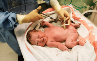 Are there Consequences of Immediate versus Delayed Umbilical Cord Clamping and Cutting at Birth