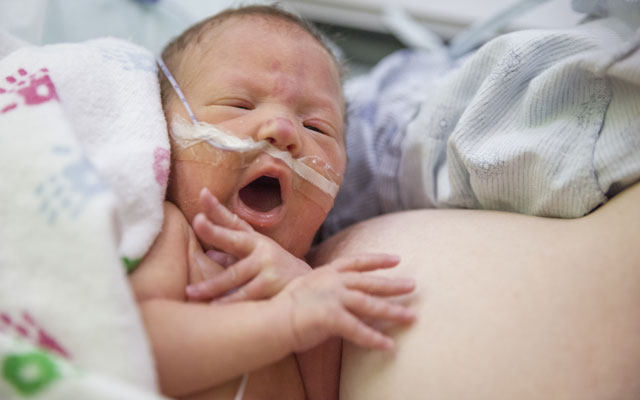Assisting the Non Latching Infant to Breastfeed