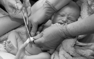 immediate vs delayed cord clamping