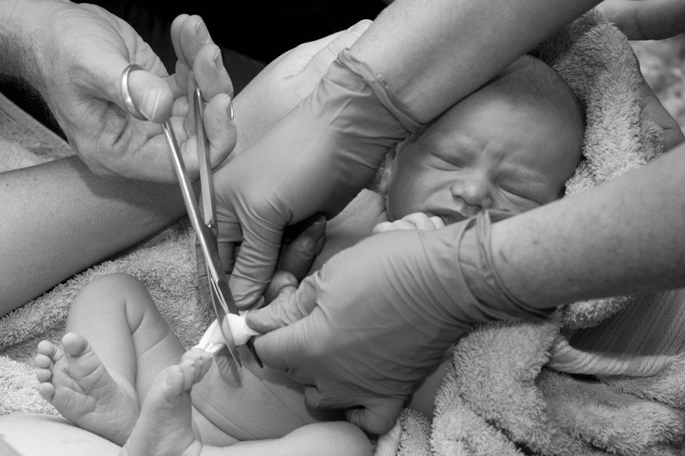 immediate vs delayed cord clamping large