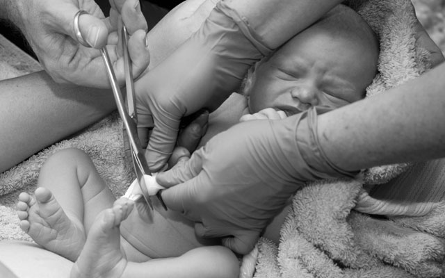 immediate vs delayed cord clamping
