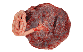 Placenta Pleasantries and Possibilities – What To Do With Your Placenta