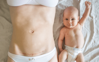 Caesareans linked to increased infertility