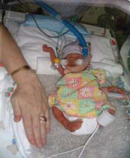 Molly in NICU