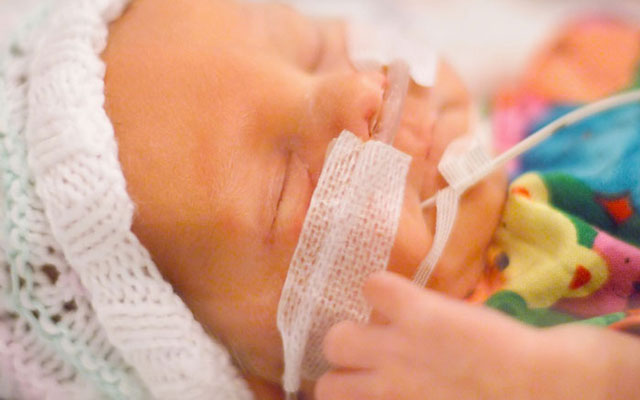 Twins The Early Hours in Neonatal Intensive Care