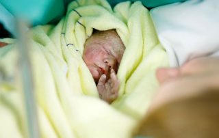 What are the implications of an increasing caesarean section rate