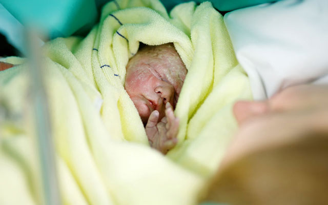What are the implications of an increasing caesarean section rate