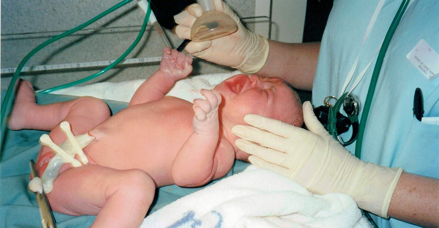 Implications of neonatal morbidity