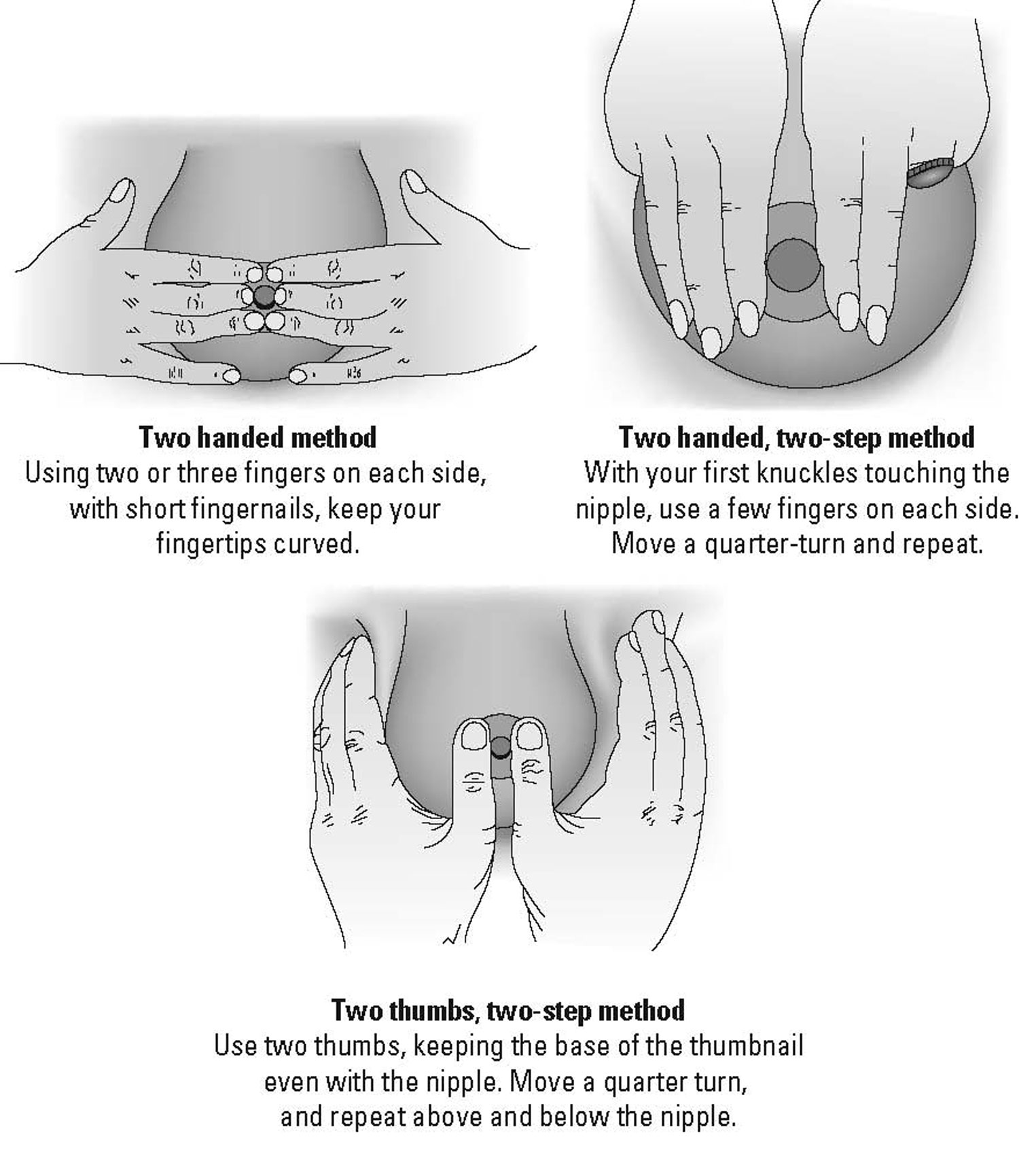 Reverse pressure softening