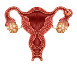 ectopic pregnancy