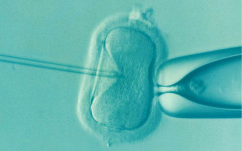 Understanding IVF