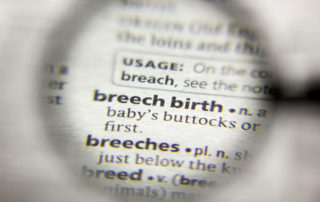 breech birth links