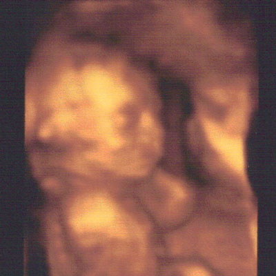 The first time I meet You Ultrasound