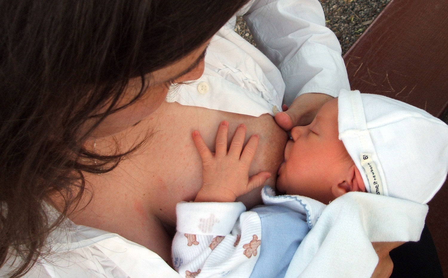 Breast engorgement  Pregnancy Birth and Baby