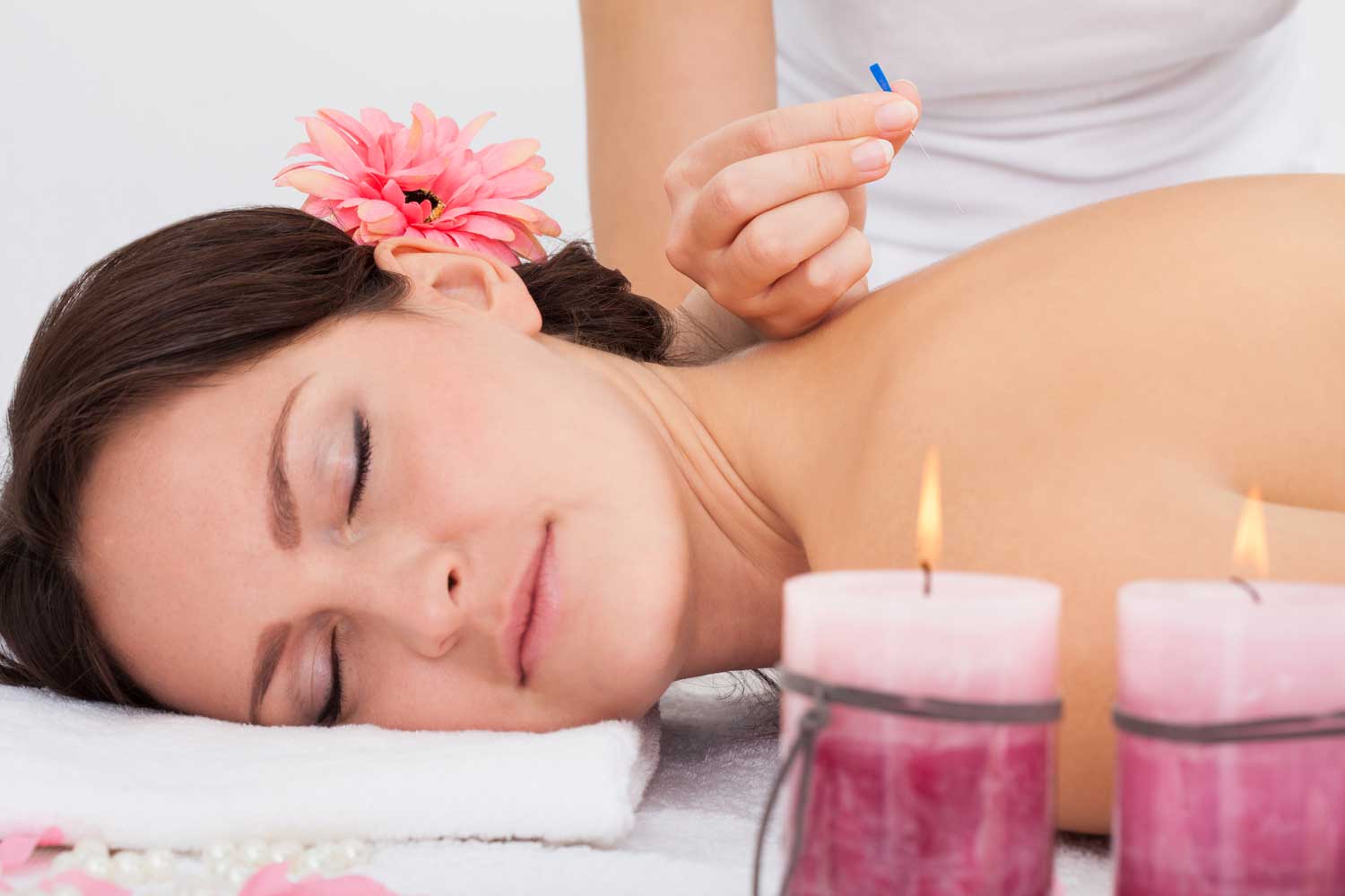 Acupuncture Beats Morning Sickness