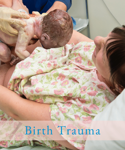 Birth trauma