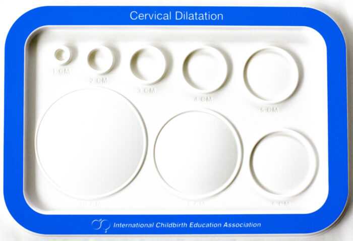 Cervical Dilatation Chart